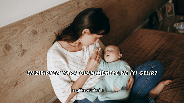 Emzirirken Yara Olan Memeye Ne İyi Gelir?