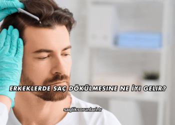 Erkeklerde Saç Dökülmesine Ne İyi Gelir?