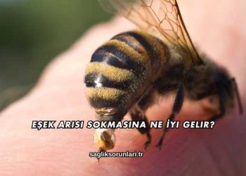 Eşek Arısı Sokmasına Ne İyi Gelir?