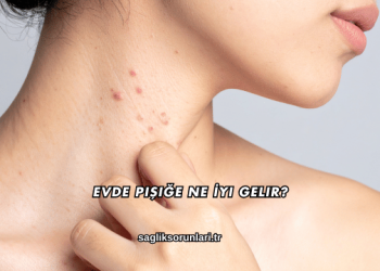 Evde Pişiğe Ne İyi Gelir?