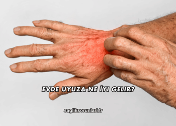 Evde Uyuza Ne İyi Gelir?