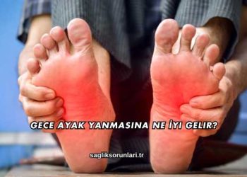 Gece Ayak Yanmasına Ne İyi Gelir?