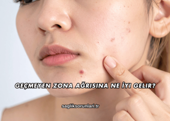 Geçmeyen Zona Ağrısına Ne İyi Gelir?