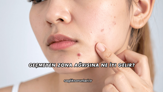 Geçmeyen Zona Ağrısına Ne İyi Gelir?