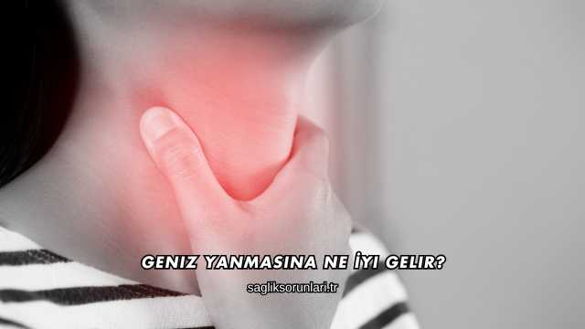 Geniz Yanmasına Ne İyi Gelir?