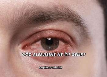 Göz Alerjisine Ne İyi Gelir?
