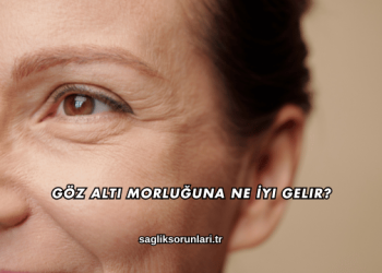 Göz Altı Morluğuna Ne İyi Gelir?