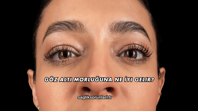 Göz Altı Morluğuna Ne İyi Gelir?