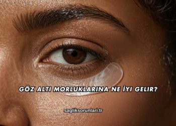 Göz Altı Morluklarına Ne İyi Gelir?