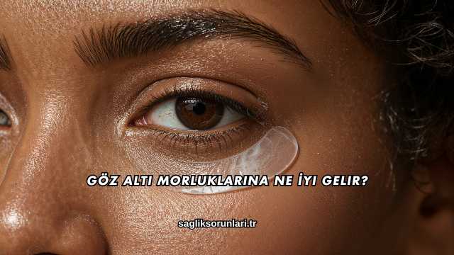 Göz Altı Morluklarına Ne İyi Gelir?