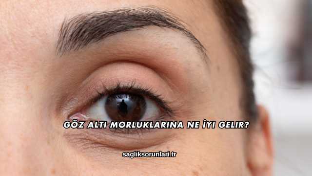 Göz Altı Morluklarına Ne İyi Gelir?