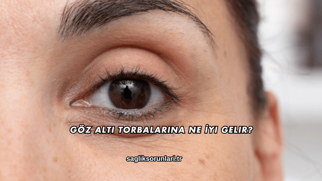 Göz Altı Torbalarına Ne İyi Gelir?