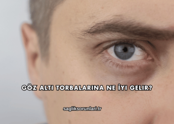 Göz Altı Torbalarına Ne İyi Gelir?