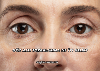 Göz Altı Torbalarına Ne İyi Gelir?