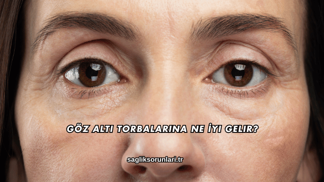 Göz Altı Torbalarına Ne İyi Gelir?