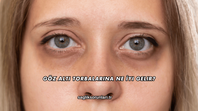 Göz Altı Torbalarına Ne İyi Gelir?