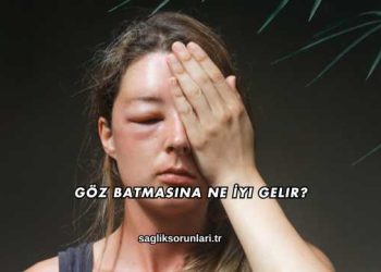 Göz Batmasına Ne İyi Gelir?