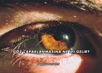 Göz Çapaklanmasına Ne İyi Gelir?