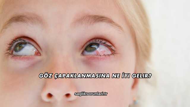 Göz Çapaklanmasına Ne İyi Gelir?