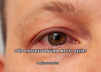 Göz Enfeksiyonuna Ne İyi Gelir?