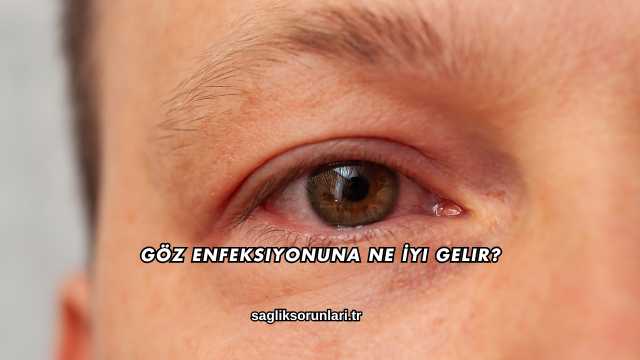 Göz Enfeksiyonuna Ne İyi Gelir?