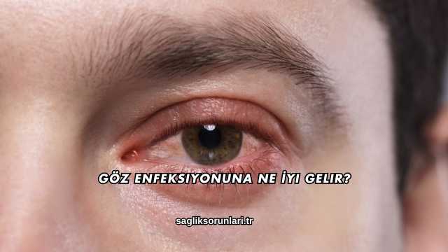 Göz Enfeksiyonuna Ne İyi Gelir?