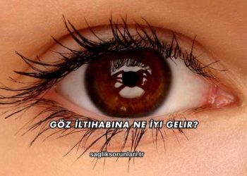 Göz İltihabına Ne İyi Gelir?