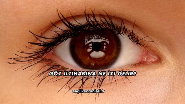 Göz İltihabına Ne İyi Gelir?