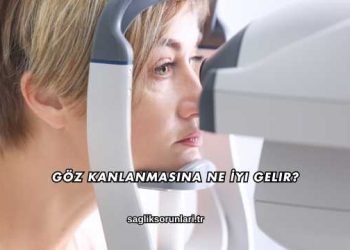 Göz Kanlanmasına Ne İyi Gelir?