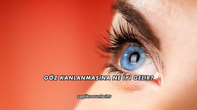 Göz Kanlanmasına Ne İyi Gelir?