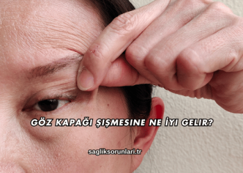 Göz Kapağı Şişmesine Ne İyi Gelir?