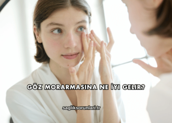 Göz Morarmasına Ne İyi Gelir?