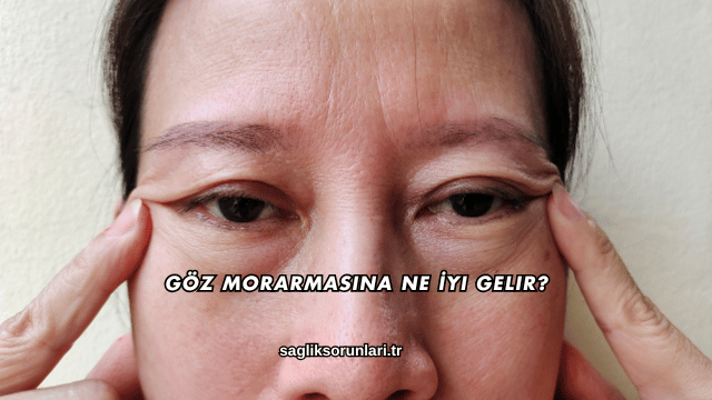 Göz Morarmasına Ne İyi Gelir?