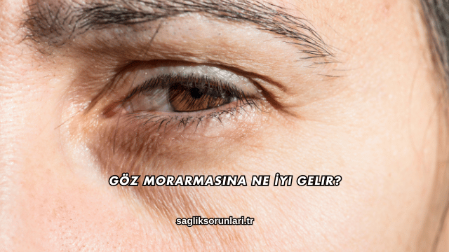 Göz Morarmasına Ne İyi Gelir?