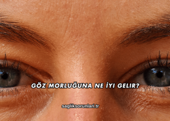 Göz Morluğuna Ne İyi Gelir?