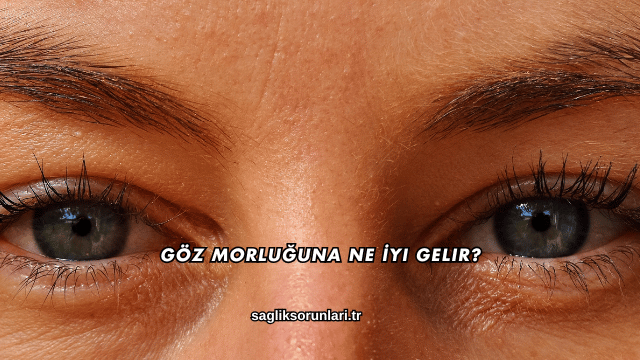 Göz Morluğuna Ne İyi Gelir?