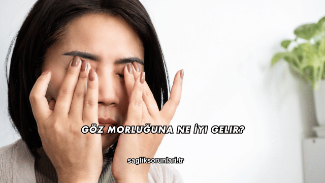 Göz Morluğuna Ne İyi Gelir?