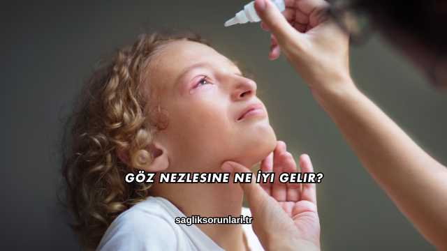 Göz Nezlesine Ne İyi Gelir?