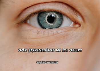 Göz Şişkinliğine Ne İyi Gelir?