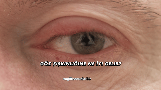 Göz Şişkinliğine Ne İyi Gelir?