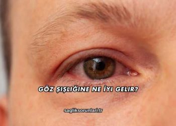 Göz Şişliğine Ne İyi Gelir?