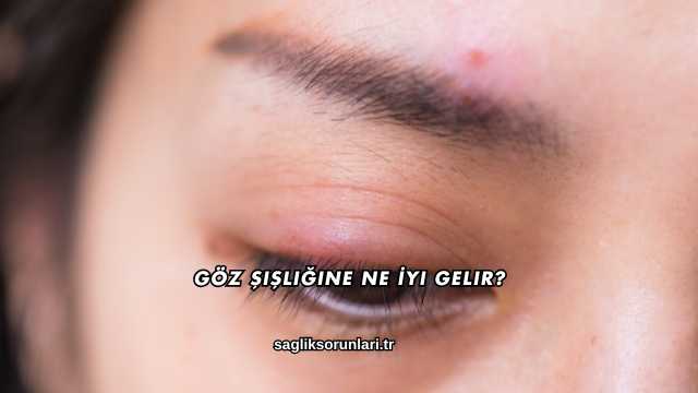 Göz Şişliğine Ne İyi Gelir?