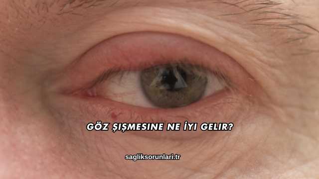 Göz Şişmesine Ne İyi Gelir?
