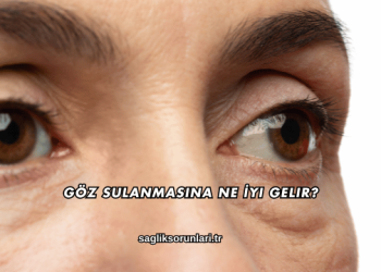 Göz Sulanmasına Ne İyi Gelir?