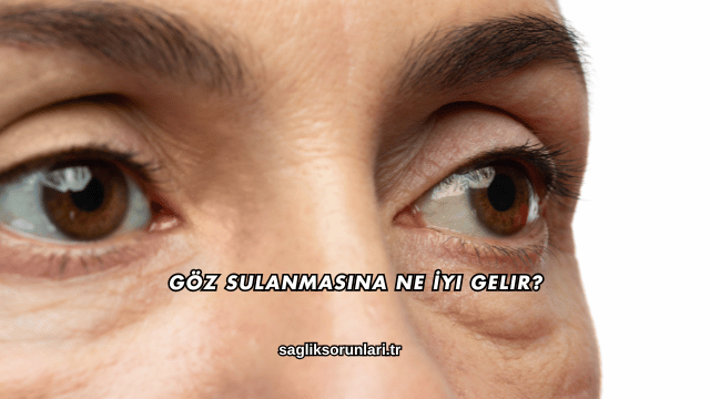 Göz Sulanmasına Ne İyi Gelir?