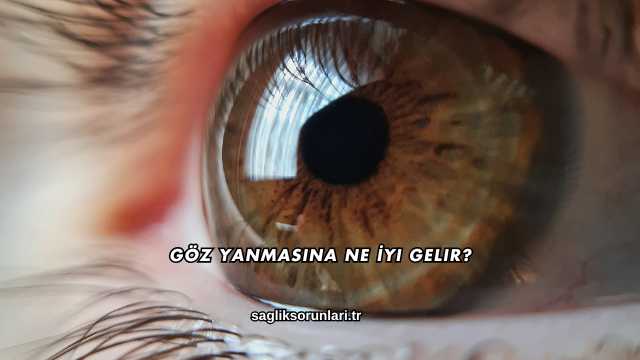 Göz Yanmasına Ne İyi Gelir?