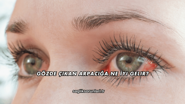 Gözde Çıkan Arpacığa Ne İyi Gelir?