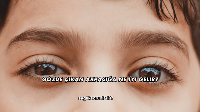 Gözde Çıkan Arpacığa Ne İyi Gelir?