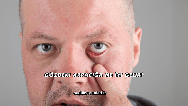 Gözdeki Arpacığa Ne İyi Gelir?