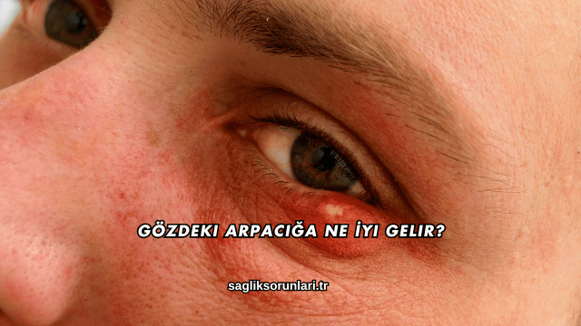 Gözdeki Arpacığa Ne İyi Gelir?